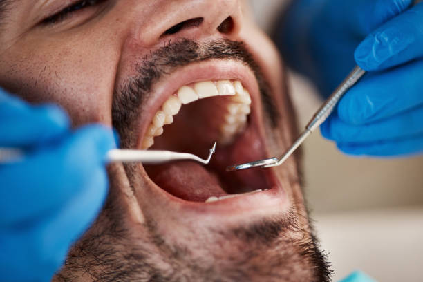 Best Knocked-Out Tooth Emergency  in Goldsboro, NC